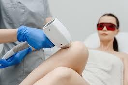 Girne Lazer Epilasyon - Blog yazısı görseli